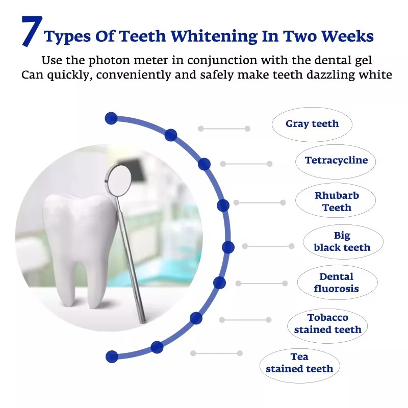 Intelligent LED Blue Light Por - огляд і ціна Teeth Whitening For Trays