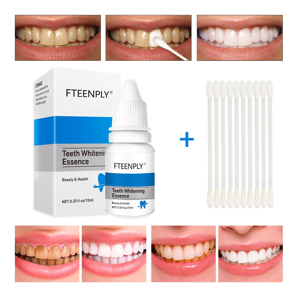 FTEENPLY Teeth Whitening Essen - огляд і ціна Teeth Whitening Street