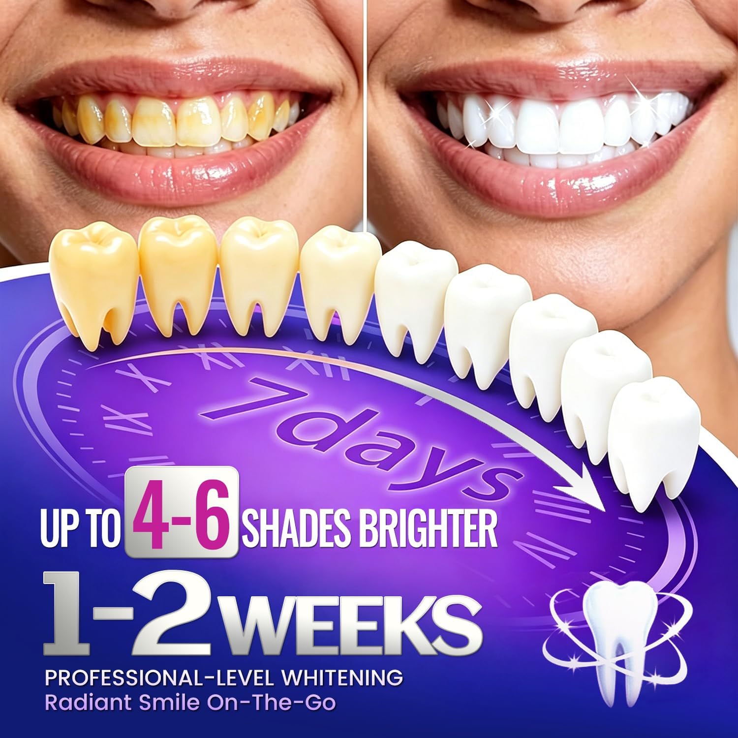 1/7 Pairs Teeth Whitening Stri - огляд і ціна Teeth Whitening Retainer