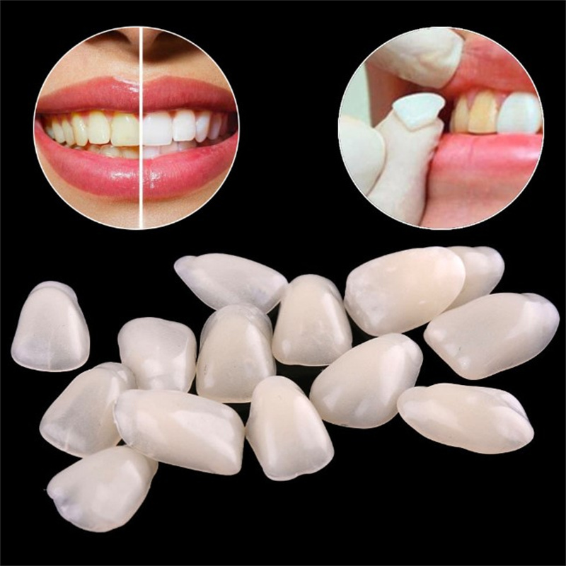 Temporary Dental Veneers - Ult - огляд і ціна Teeth Whitening Veneers