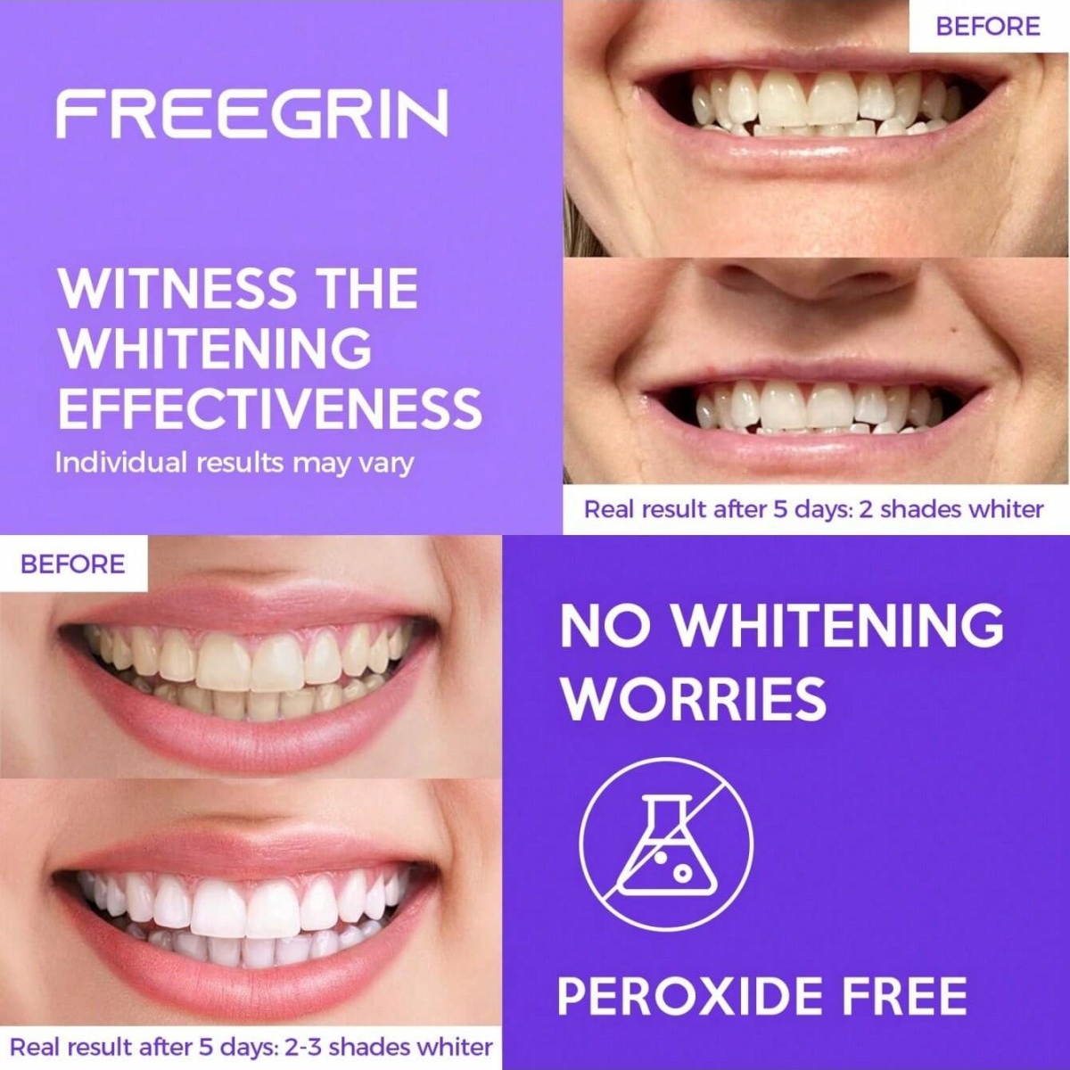 Deluxe Whitening Teeth Sticker - огляд і ціна Teeth Whitening Retainer
