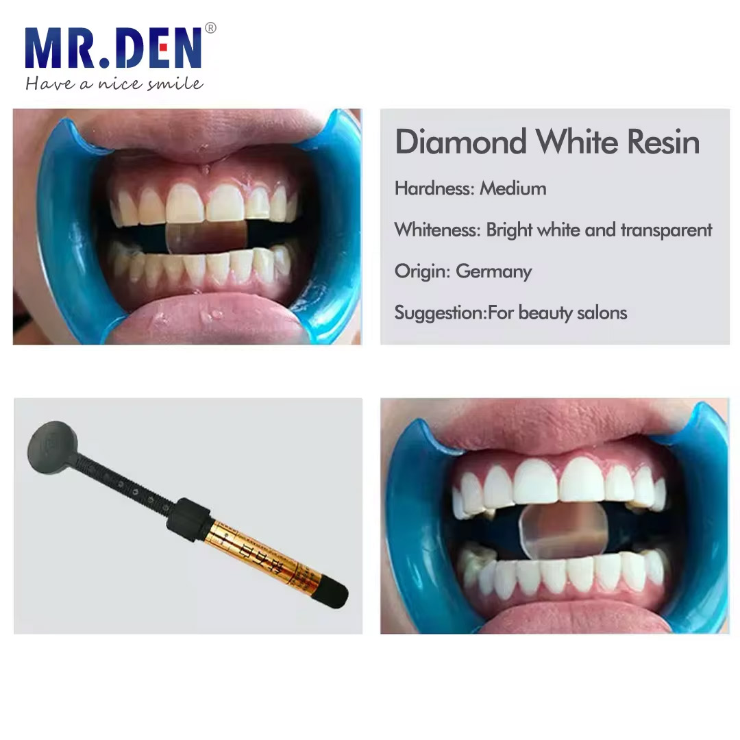 Nano Enamel Veneer Material Te - огляд і ціна Teeth Whitening Veneers