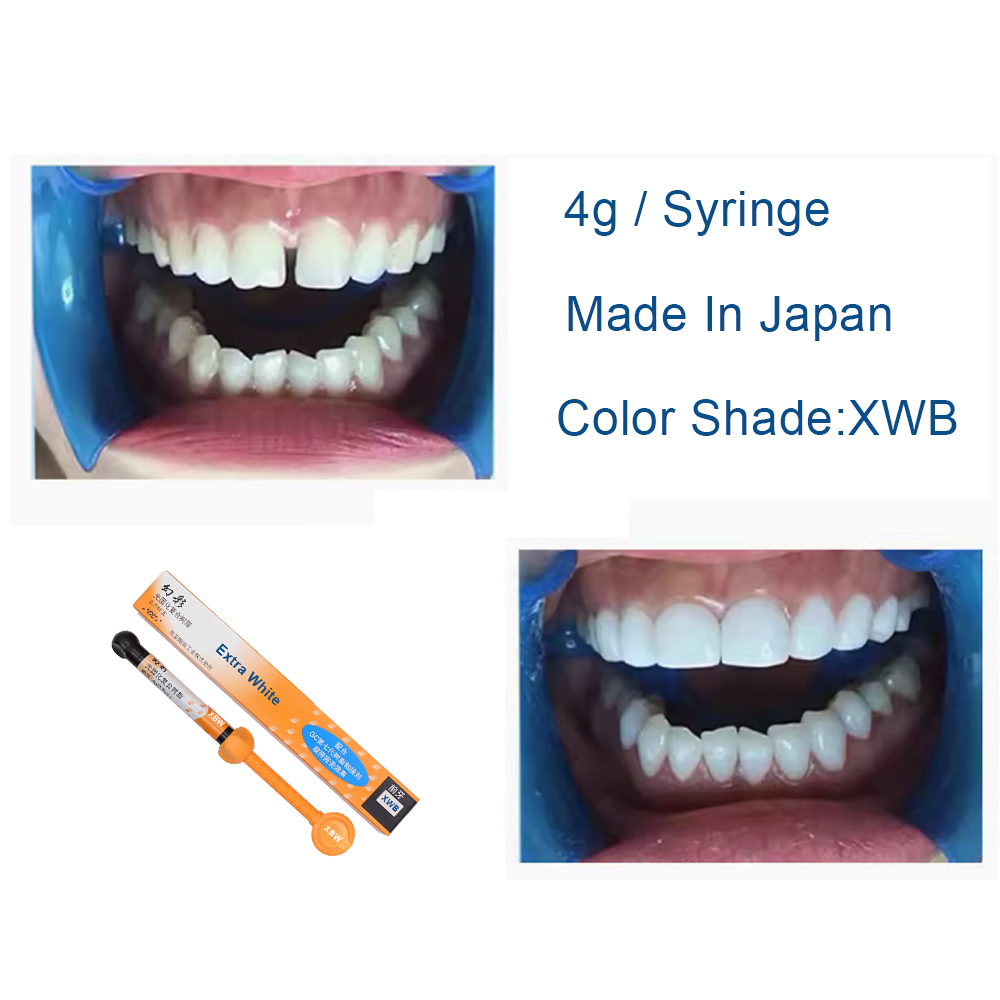 Dental Composite Resin Extra W - огляд і ціна Teeth Whitening Veneers